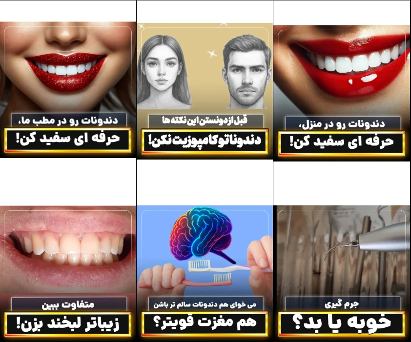 روکش دندان ارزان در کرج